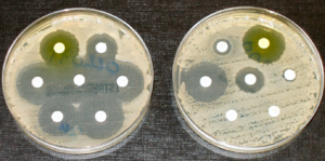 The plate on the left shows how different antibiotics (soaked into a small white disc) can kill bacteria (the clear halo around the white disc showing no bacteria). On the second plate, some of the antibiotics can no longer kill bacteria, which indicates antimicrobial resistance.