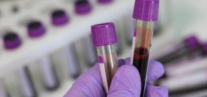 researcher wearing purple gloves holds two vials of blood. more vials are seen in a rack in the background.